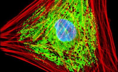pco.pixelfly gallery: Multiprobe Fluorescence Imaging