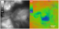 Widefield FLIM of Protoporphyrin IX