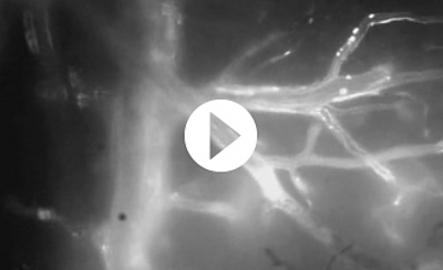 pco.1600 gallery: Fluorescence Microscopy