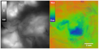 Widefield FLIM of Protoporphyrin IX